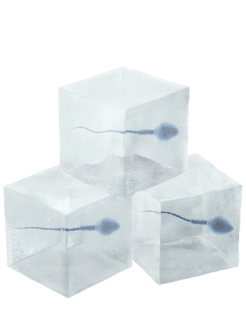 When Is Sperm Freezing Recommended?