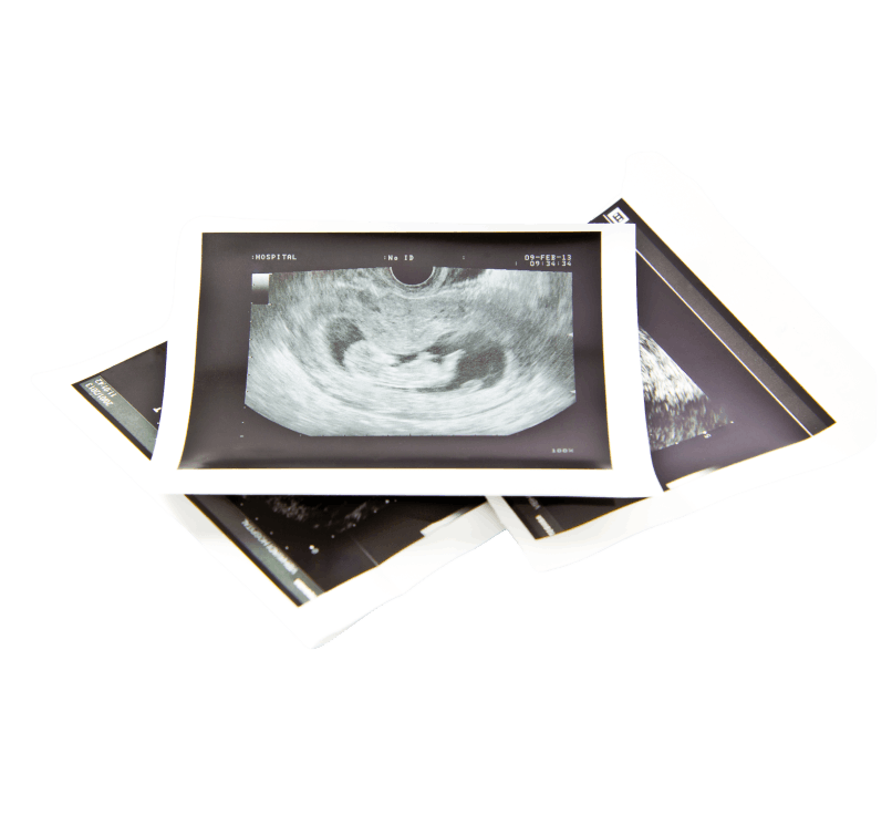 What does a transvaginal ultrasound show?